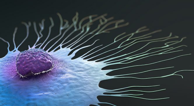 Investigación en cáncer Científicos españoles crean un fármaco con nanopartículas que previene el desarrollo de metástasis